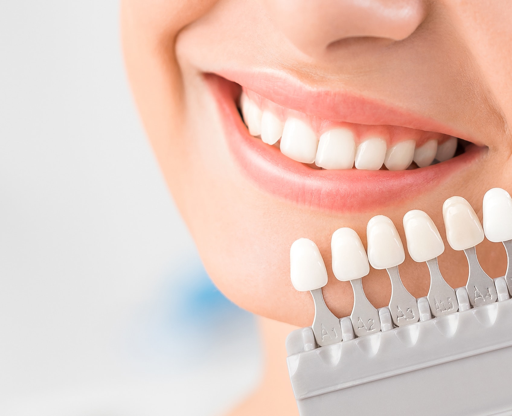 牙齿美白 | 安全高效的冷光美白 - 贝致——专业口腔服务平台，让你变美的牙套交流社区